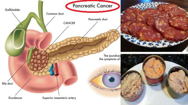 Cancer causing foods. 