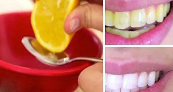 How to whiten yellow teeth. 