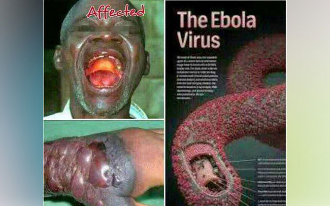 Ebola vaccine in 2015. 