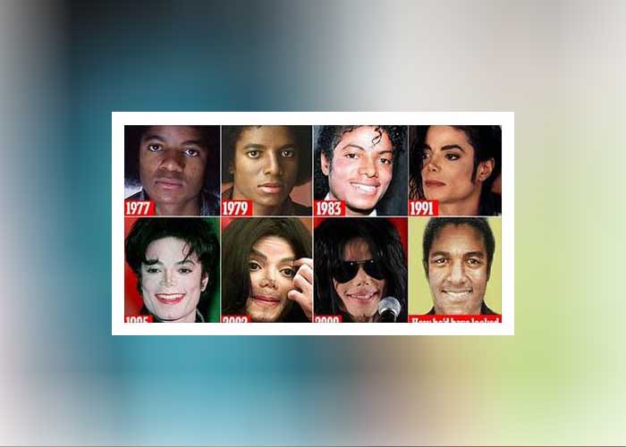 Photos: How Michael Jackson ruined his face in 100 operations
