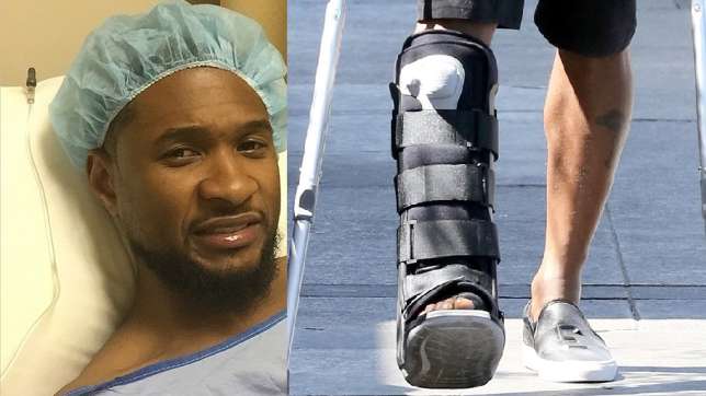 Will Usher ever dance again after $6Million leg surgery?